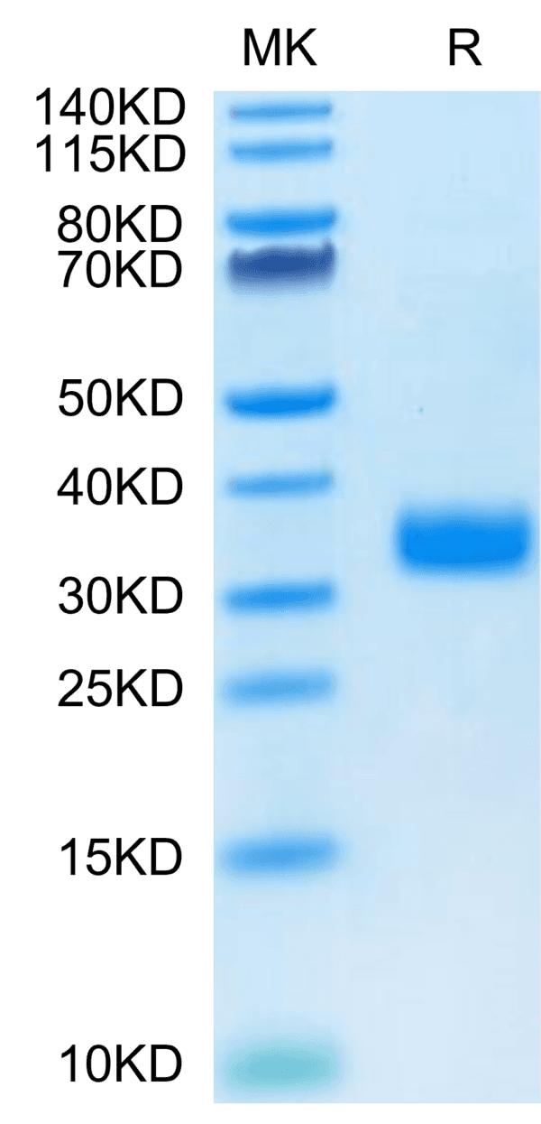 SDS-PAGE gel of Human ANGPTL4/Angiopoietin-like 4 Protein 4316