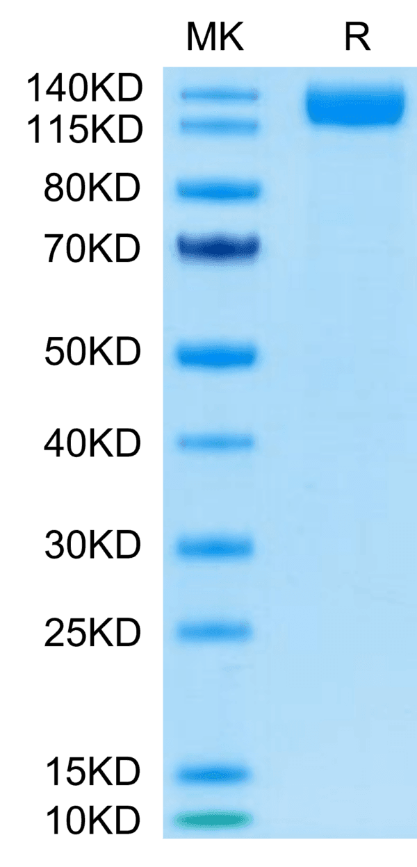 SDS-PAGE gel of SARS-COV-2 Spike S1 Protein 4325