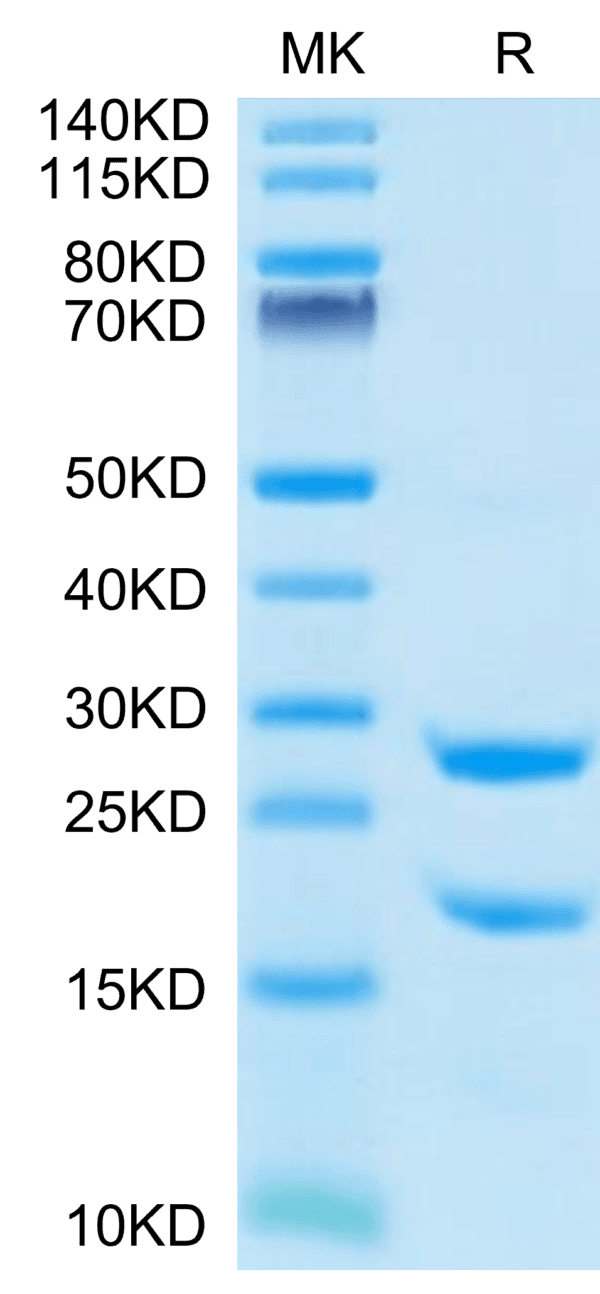 SDS-PAGE gel of Rat MASP2 Protein 4341