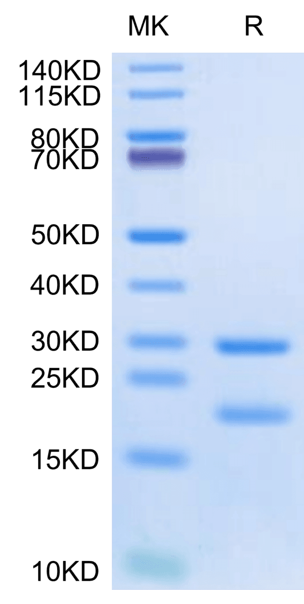 SDS-PAGE gel of Human MASP2 Protein 4367