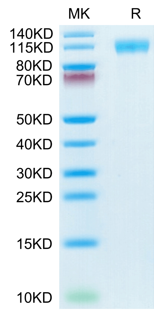 SDS-PAGE gel of SARS-COV-2 Spike S1 (N501Y,K417N,E484K) Protein 4368