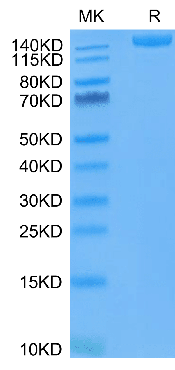 SDS-PAGE gel of SARS-COV-2 Spike S Trimer (D614G) Protein 4375