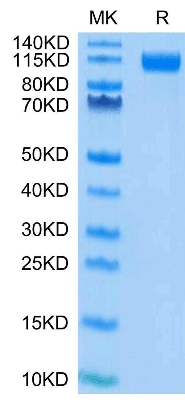 SDS-PAGE gel of SARS-COV-2 Spike S1 (D614G) Protein 4378