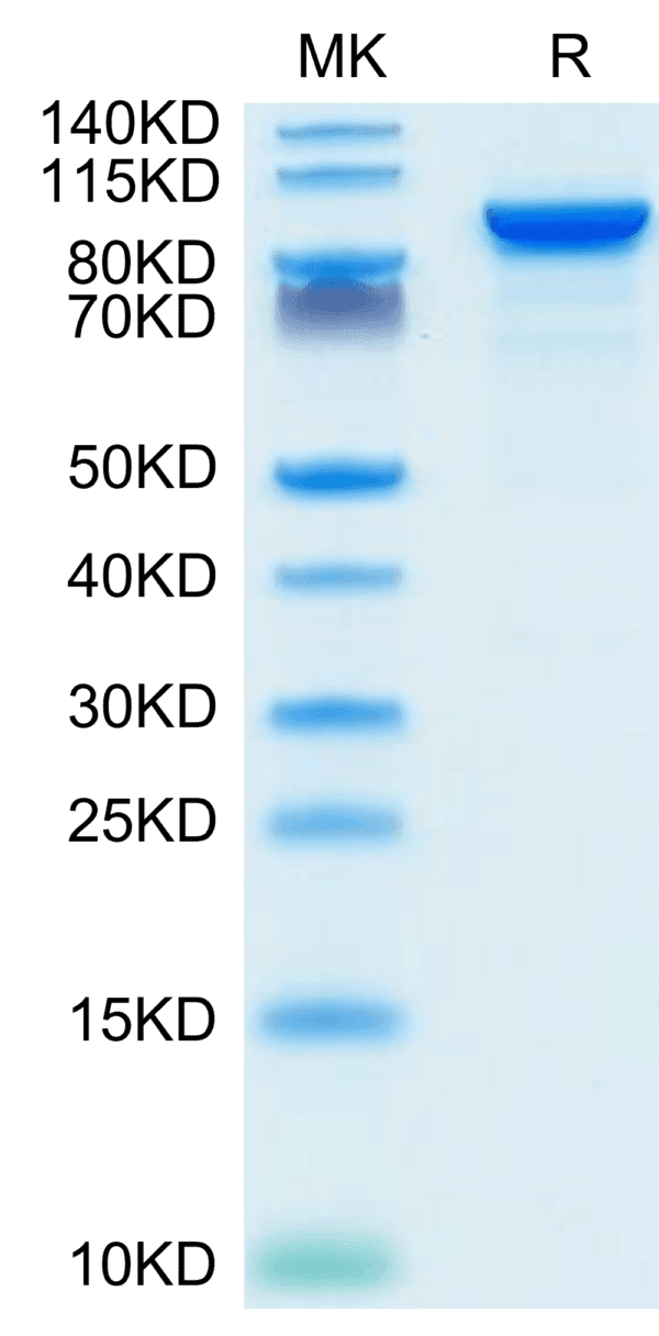 SDS-PAGE gel of Mouse ENPP-2/Autotaxin Protein 4391