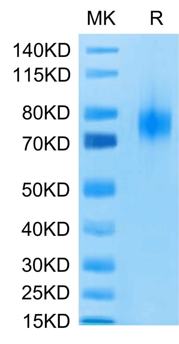 SDS-PAGE gel of Human B7-1/CD80 Protein 4413
