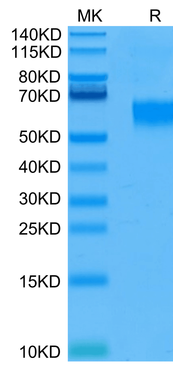 SDS-PAGE gel of Human IL-3 R alpha/CD123 Protein 4460