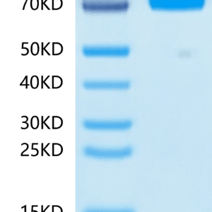 SDS-PAGE gel of Mouse CD36/SR-B3 Protein 4470