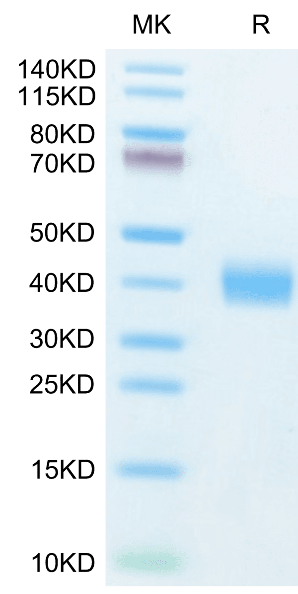 SDS-PAGE gel of Human Galectin 3 Protein 4533