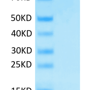 SDS-PAGE gel of Human Siglec-9 Protein 4564