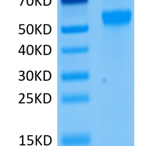 SDS-PAGE gel of Human Siglec-8 Protein 4571