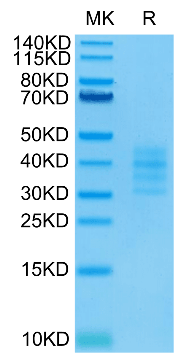 SDS-PAGE gel of Biotinylated Human BCMA/TNFRSF17 Trimer Protein 4580