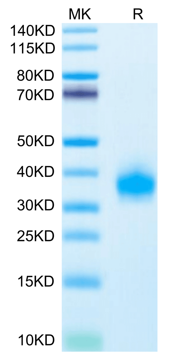 SDS-PAGE gel of Human ULBP-2 Protein 4624