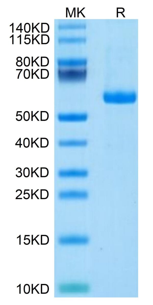 SDS-PAGE gel of Human Notch 3 Protein 4656