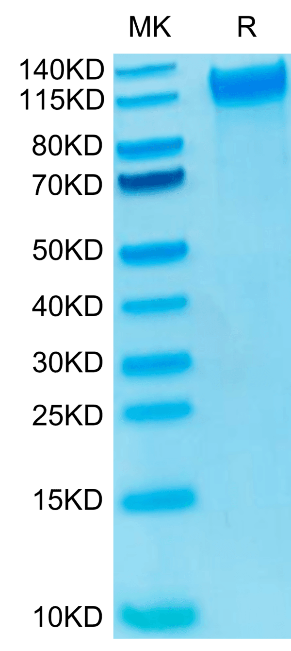 SDS-PAGE gel of Biotinylated Human P-Selectin/CD62P Protein 4676