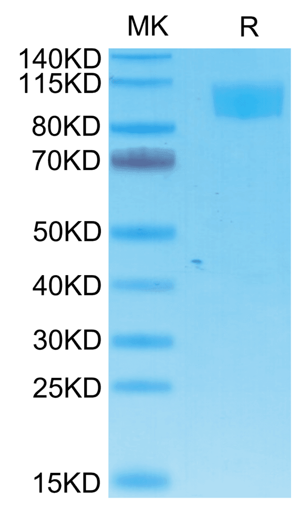 SDS-PAGE gel of Cynomolgus ACE2/ACEH Protein 4685