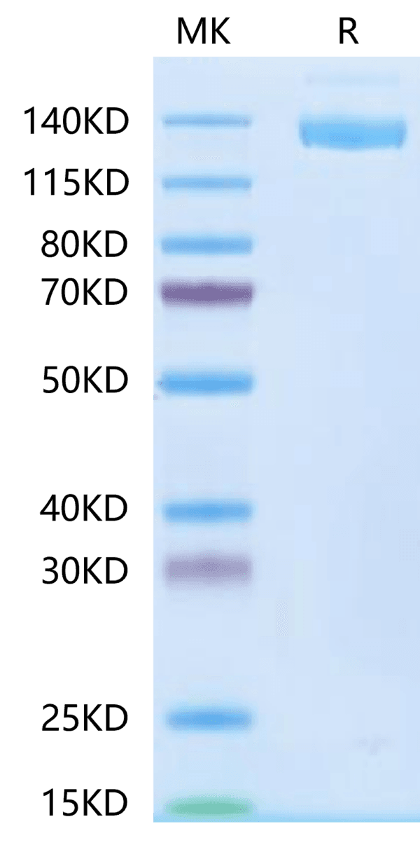 SDS-PAGE gel of SARS-COV-2 Spike S Trimer Protein 4687