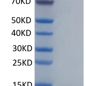 SDS-PAGE gel of Human Calprotectin (S100A8&S100A9) Protein 4698