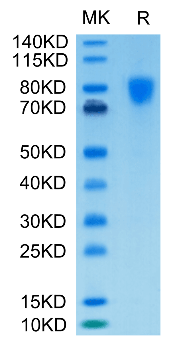 SDS-PAGE gel of Biotinylated Human PDGF R alpha/PDGFRA Protein 4719