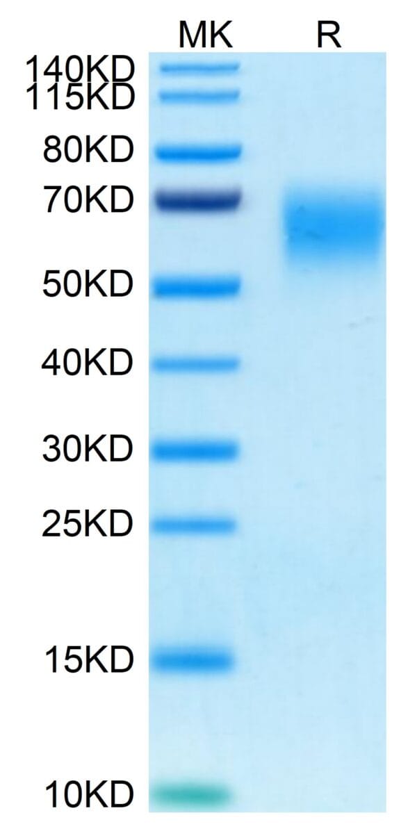 SDS-PAGE gel of Human CD200 R1/CRTR2 Protein 4735