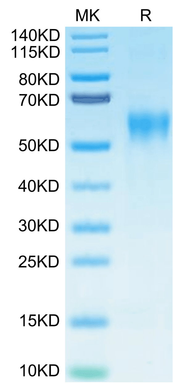 SDS-PAGE gel of Biotinylated Human IL-15RA/IL-15 R alpha/CD215 Protein 4807