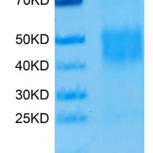 SDS-PAGE gel of Human NKG2C/CD159c Protein 4860