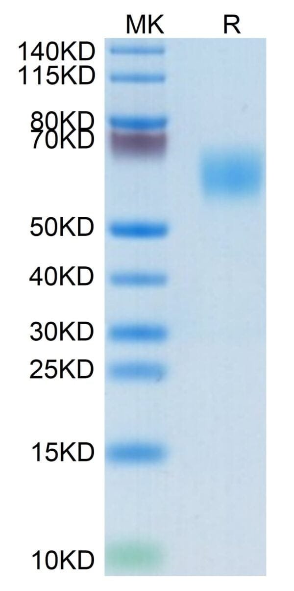 SDS-PAGE gel of Biotinylated Human MICA Protein 4869