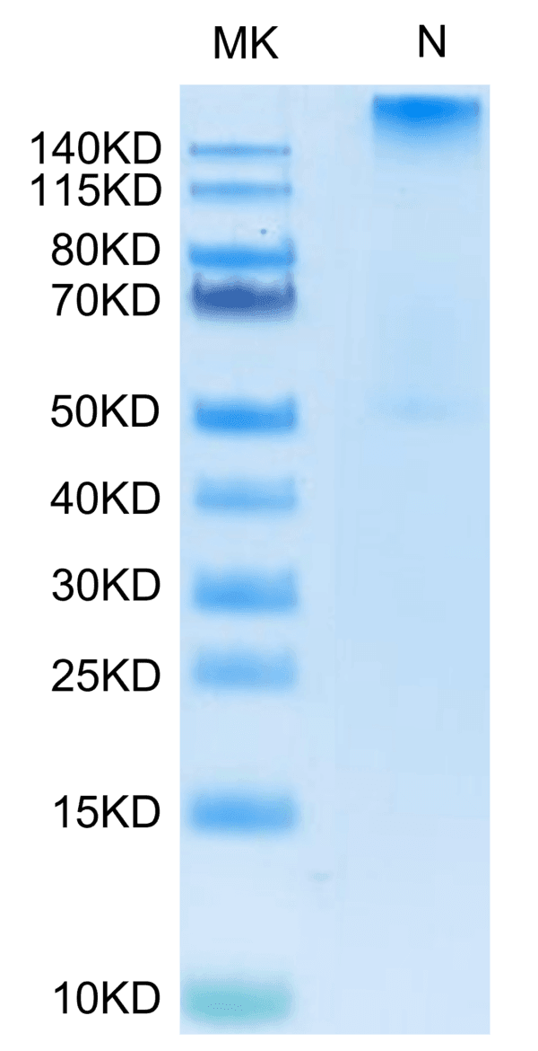 SDS-PAGE gel of Human HLA-A*02:01&B2M&WT-1 (RMFPNAPYL) Tetramer Protein 4877