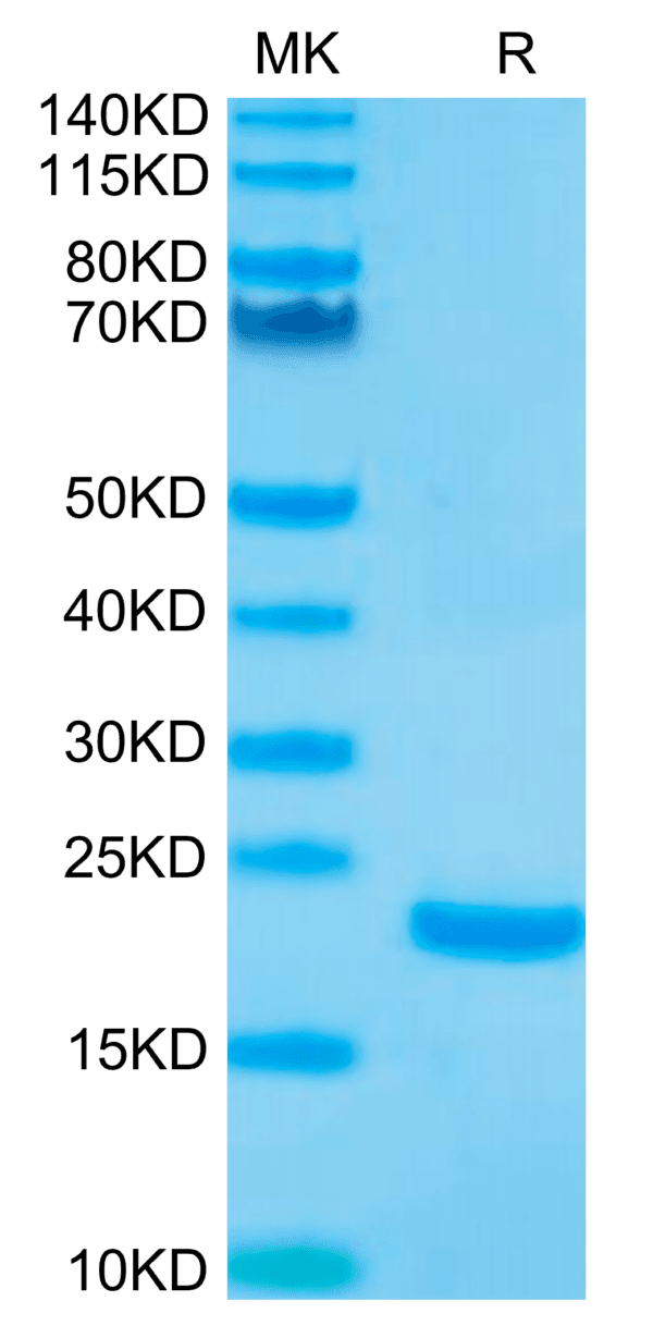 SDS-PAGE gel of Biotinylated Human IL-10 Protein 4881