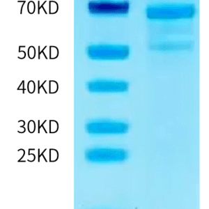 SDS-PAGE gel of Human MVK Protein 5009