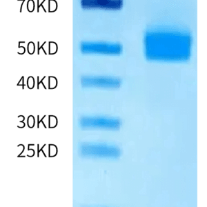 SDS-PAGE gel of Human OGN/Osteoglycin Protein 5028