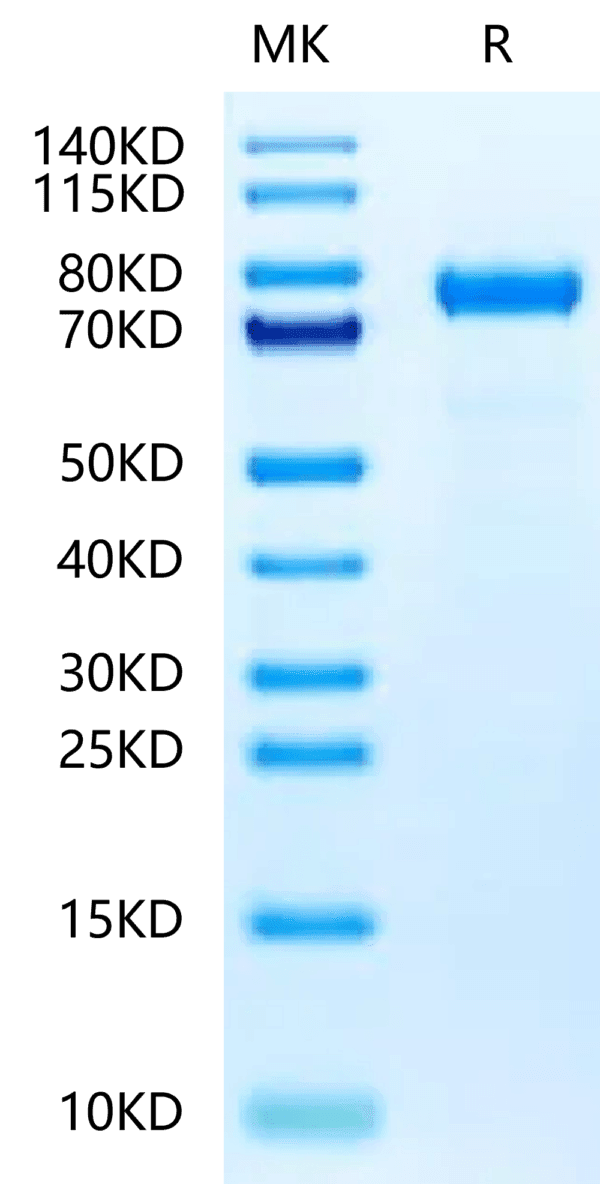 SDS-PAGE gel of Rat Coagulation Factor II?Protein 5035