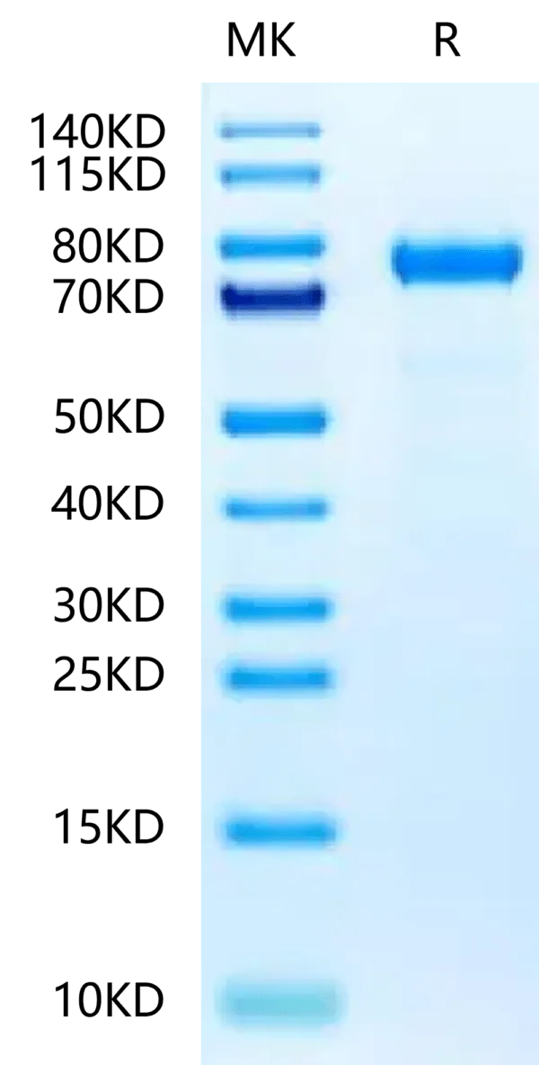 SDS-PAGE gel of Rat Coagulation Factor II?Protein 5035