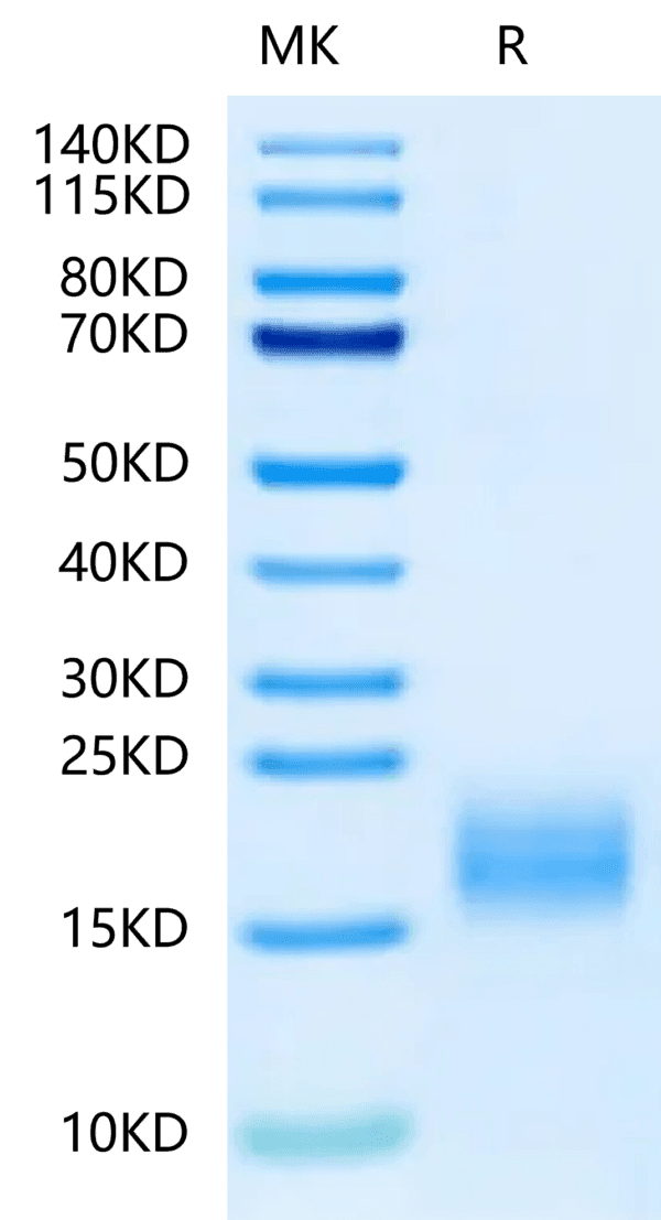 SDS-PAGE gel of Human Fibronectin (1266-1356) Protein 5036