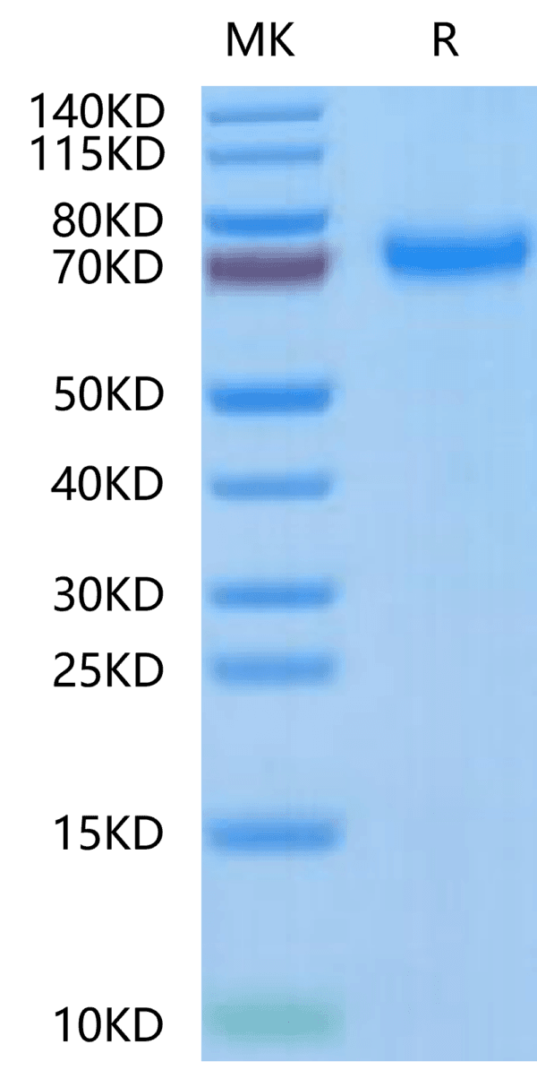 SDS-PAGE gel of Human TNFR2/CD120b/TNFRSF1B Protein 5045