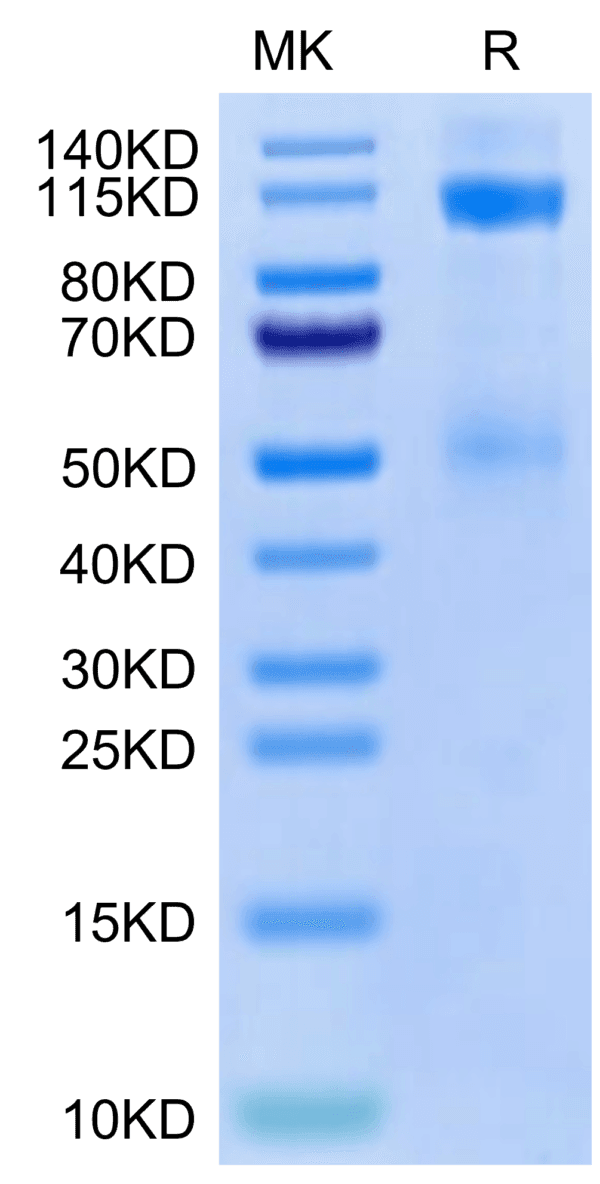 SDS-PAGE gel of Cynomolgus IGF1R/CD221 Protein 5056