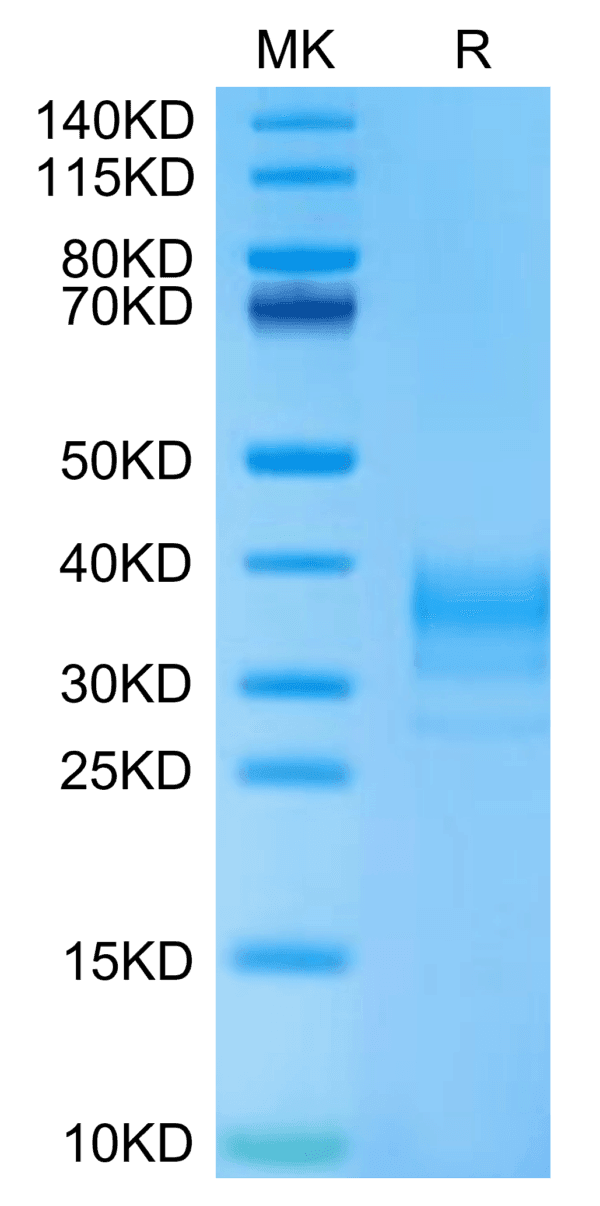 SDS-PAGE gel of Human LAMP5 Protein 5067