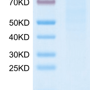 SDS-PAGE gel of Human Integrin alpha 10 beta 1 (ITGA10&ITGB1) Heterodim 5076