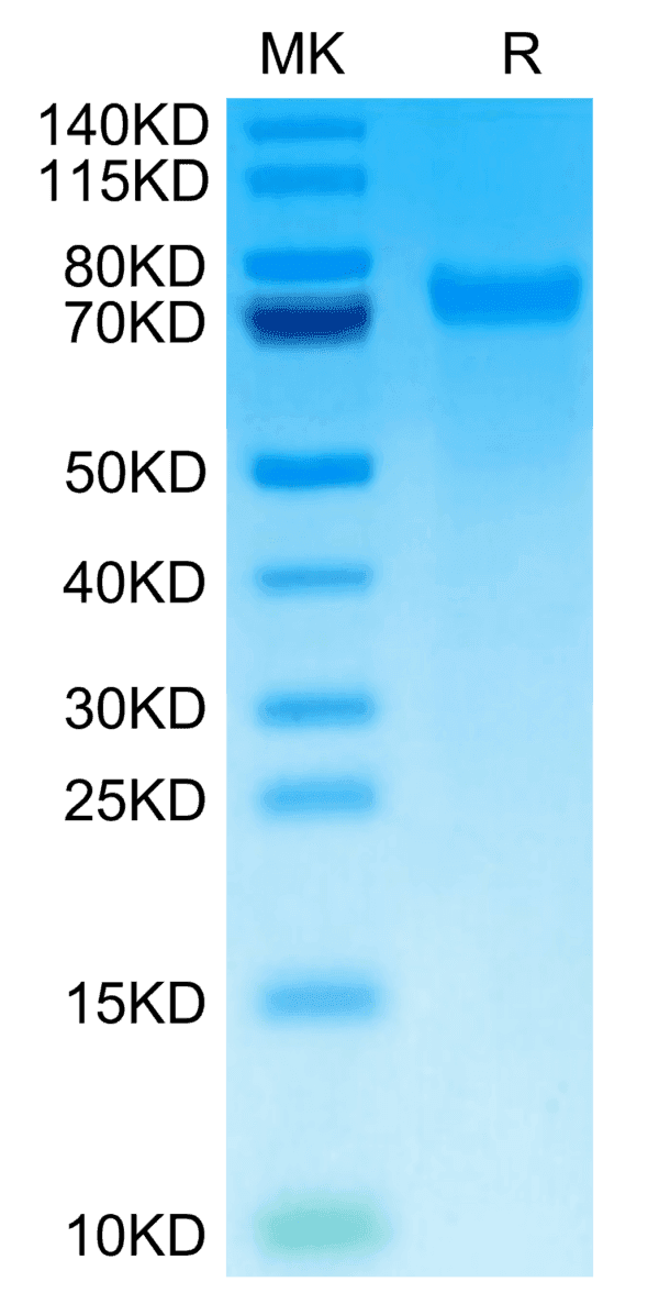 SDS-PAGE gel of Mouse Tenascin Protein 5094