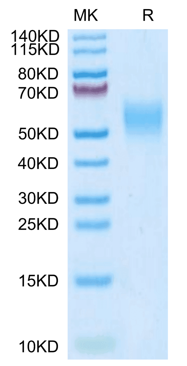 SDS-PAGE gel of Mouse IL-2 R gamma/CD132 Protein 5098