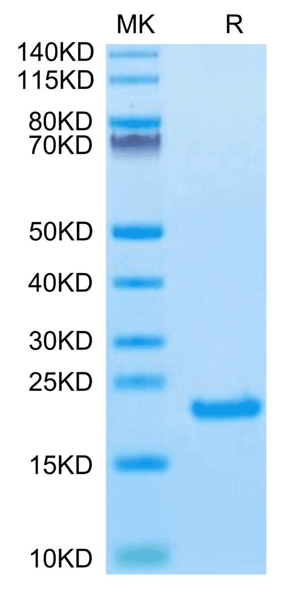 SDS-PAGE gel of Biotinylated Human IL-21 Protein 5104