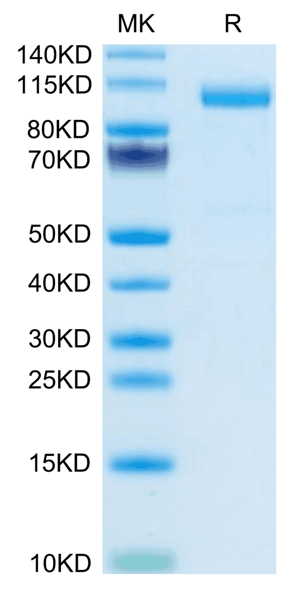 SDS-PAGE gel of Mouse Thyroid Peroxidase Protein 5114