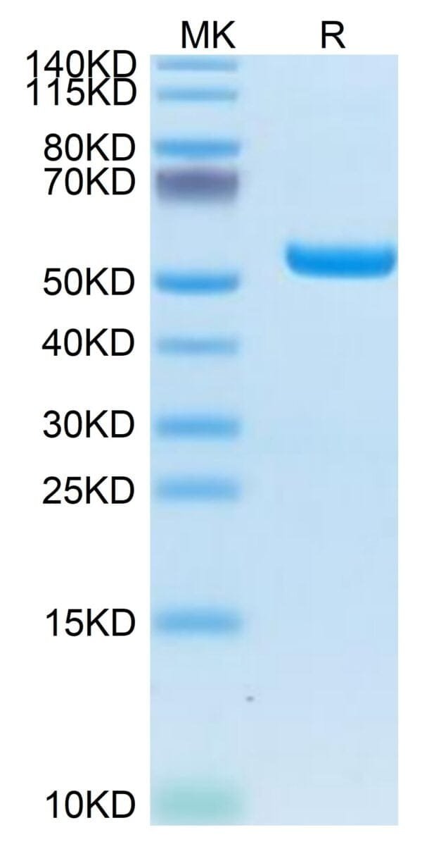 SDS-PAGE gel of Biotinylated Human HLA-A*02:01&B2M&LMP2 (CLGGLLTMV) Mon 5120