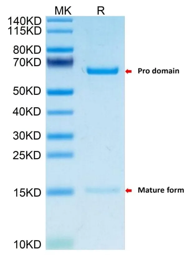 SDS-PAGE gel of Mouse PCSK9 Protein 5122