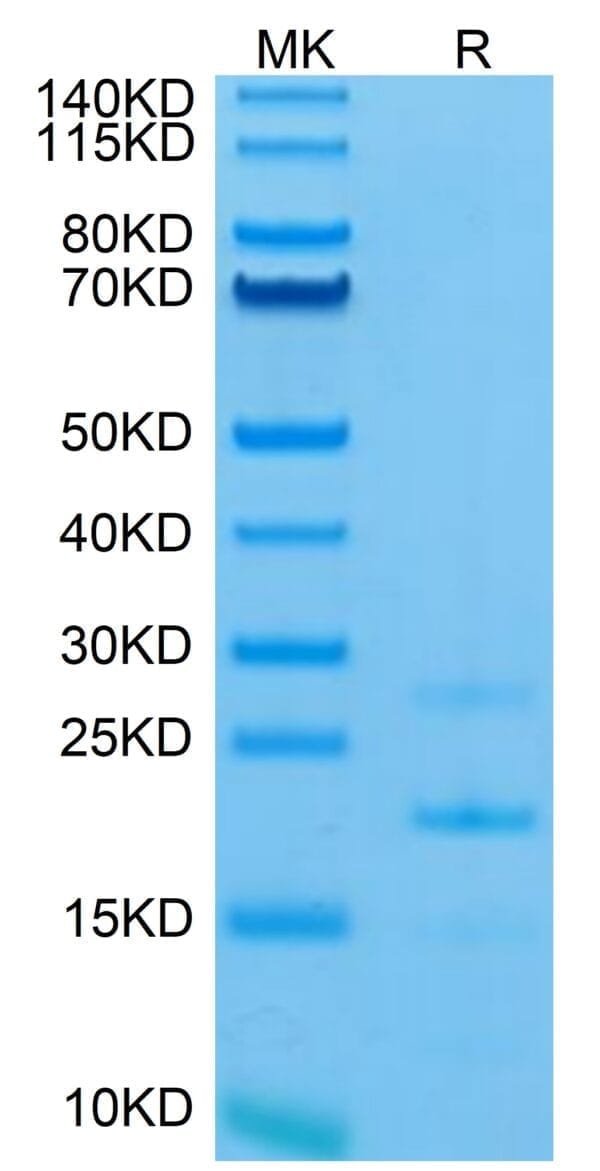 SDS-PAGE gel of Mouse MASP2 Protein 5123