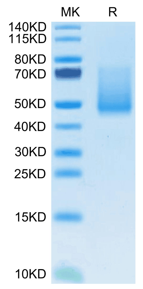 SDS-PAGE gel of Mouse ECSCR Protein 5125
