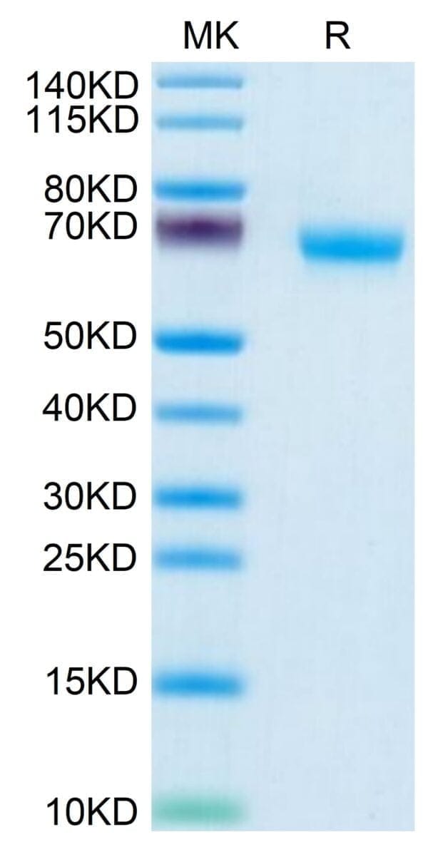 SDS-PAGE gel of Human NKp46/NCR1/CD335 Protein 5126