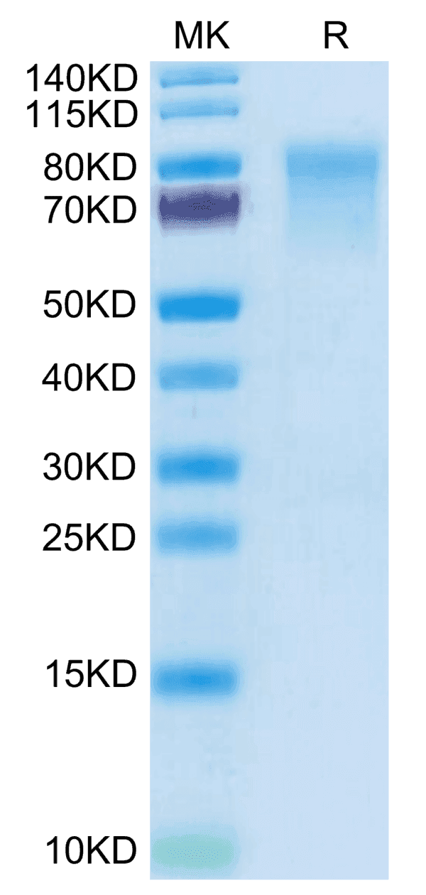 SDS-PAGE gel of Mouse IL-15RA/IL-15 R alpha/CD215 Protein 5129