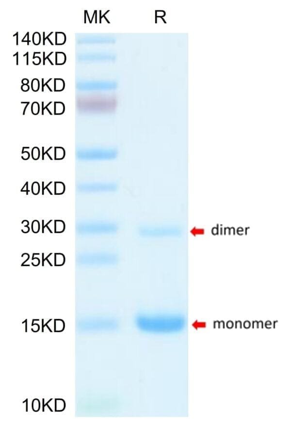 SDS-PAGE gel of Mouse S100A9/MRP14 Protein 5133