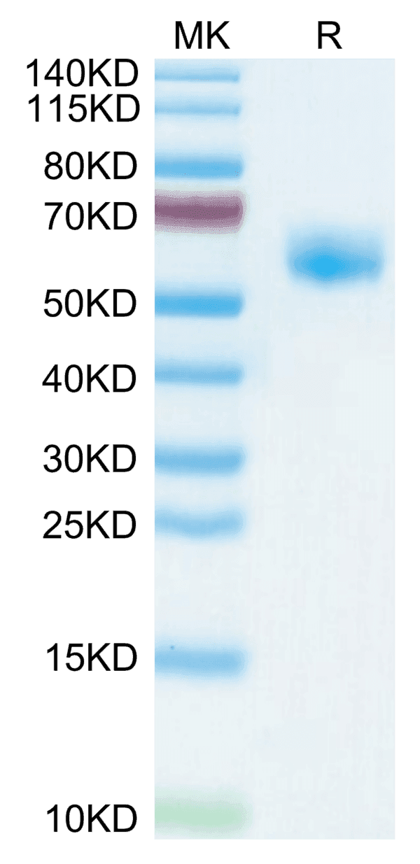 SDS-PAGE gel of Human NKG2A&CD94 Protein 5138