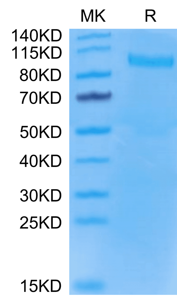 SDS-PAGE gel of Mouse TLR3 Protein 5155